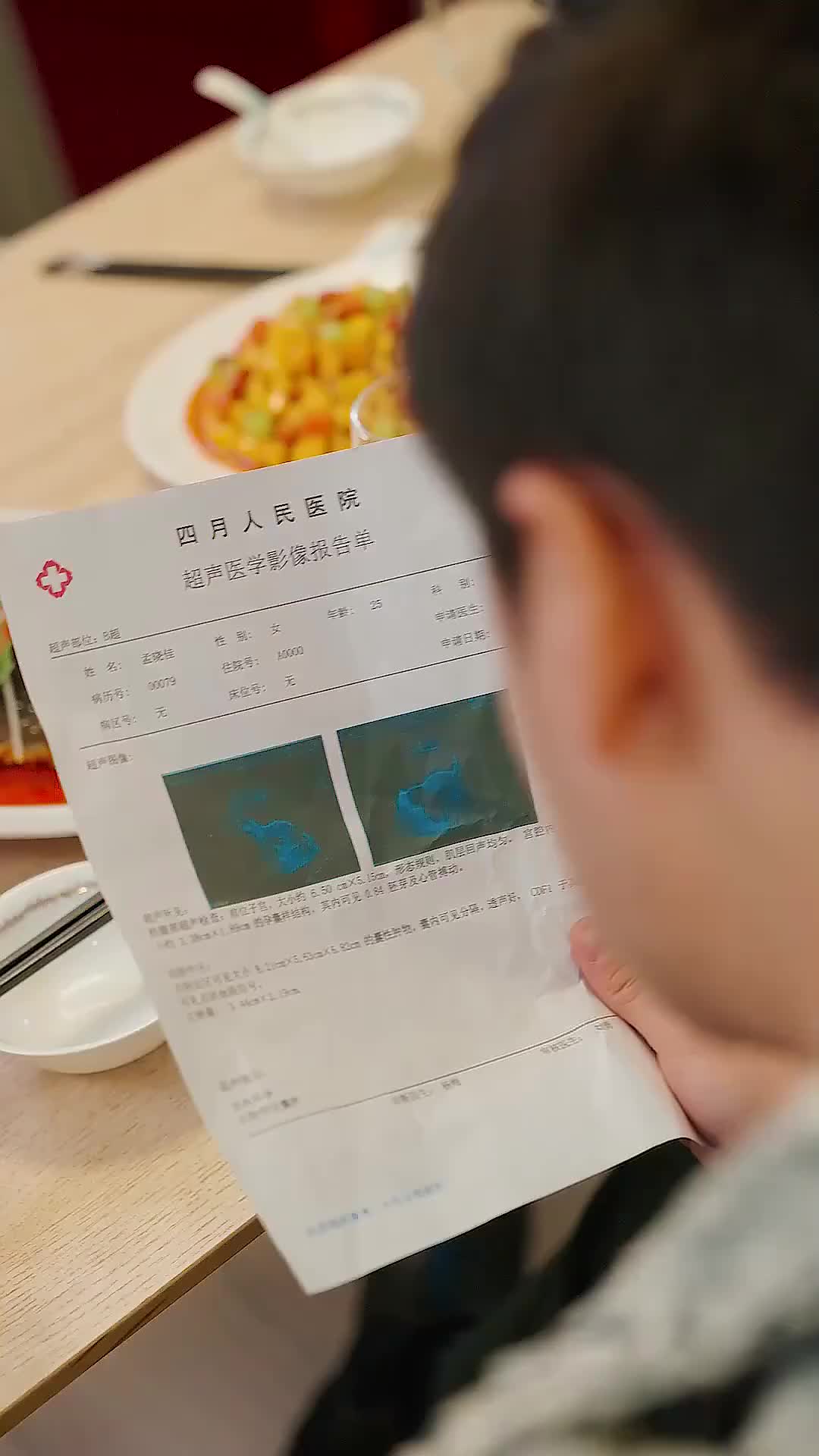 Ep 2