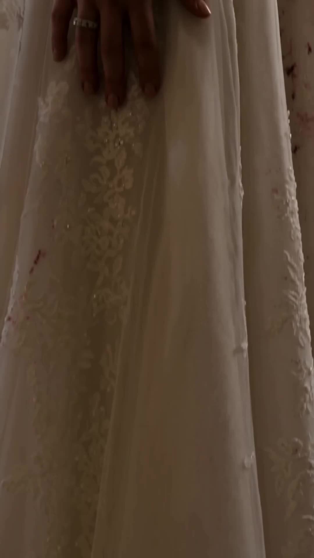 Fiancé Made Me a Bald Bride to Please His Ex Episode 8