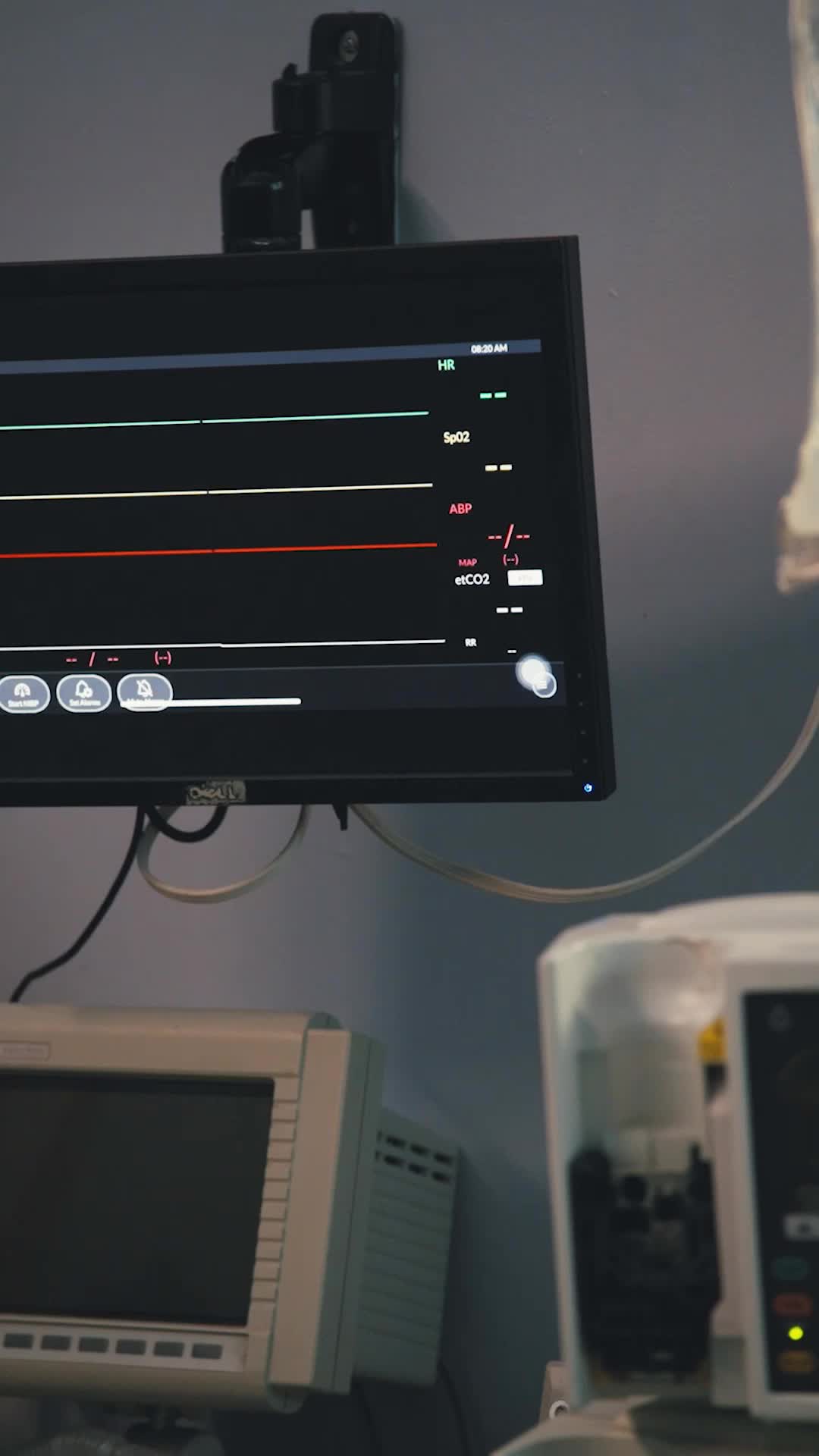 Ep 1