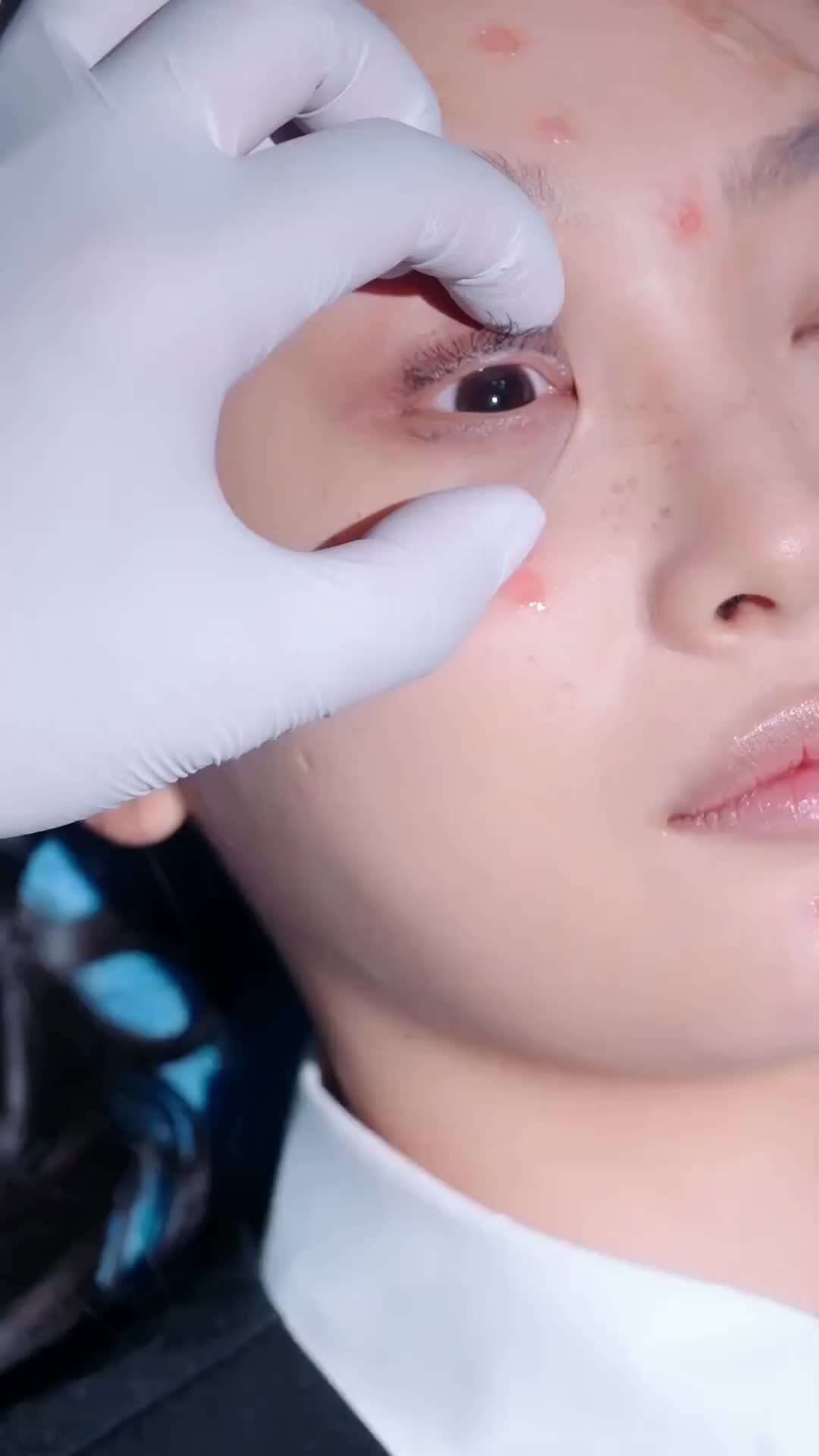 Ep 1