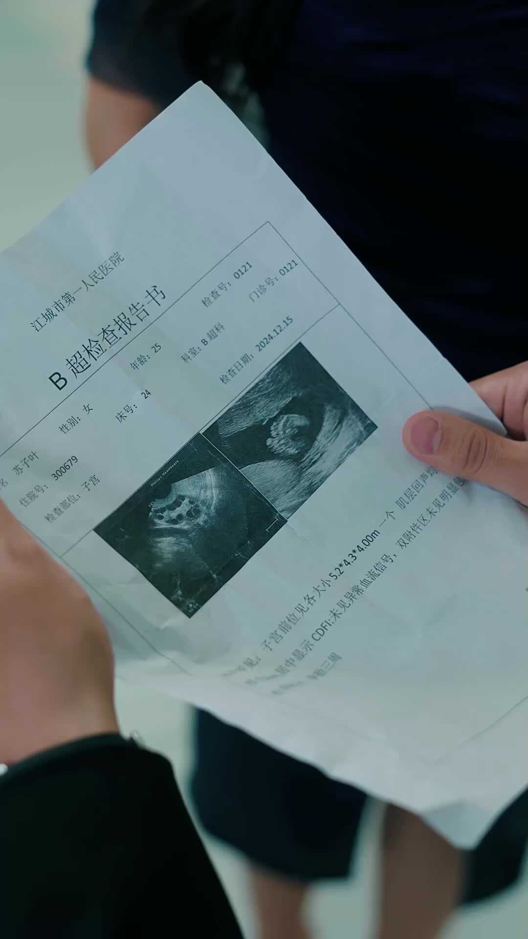 Ep 51