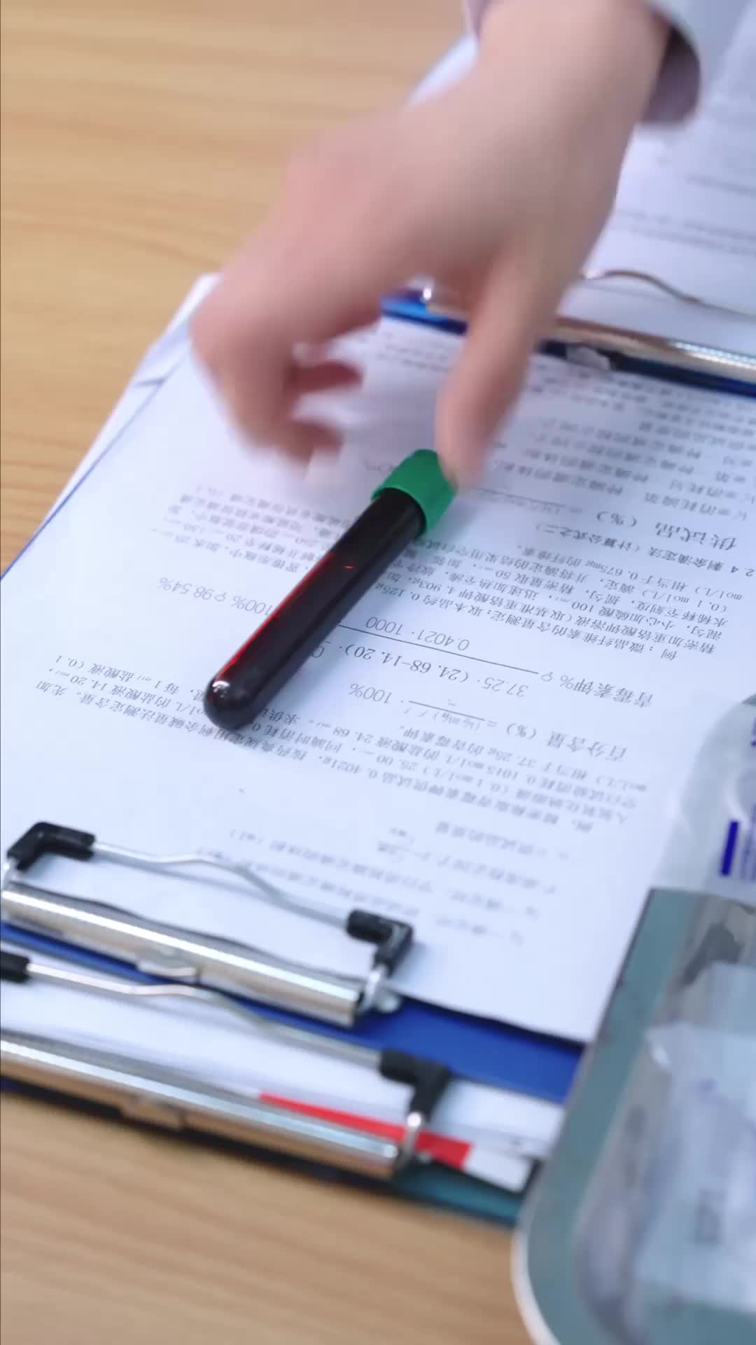 Ep 30