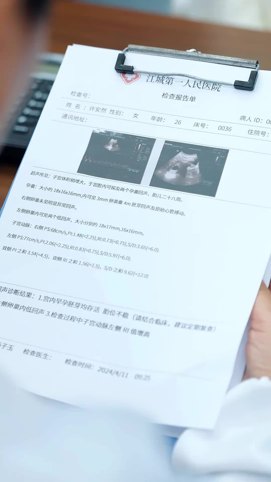 Ep 4