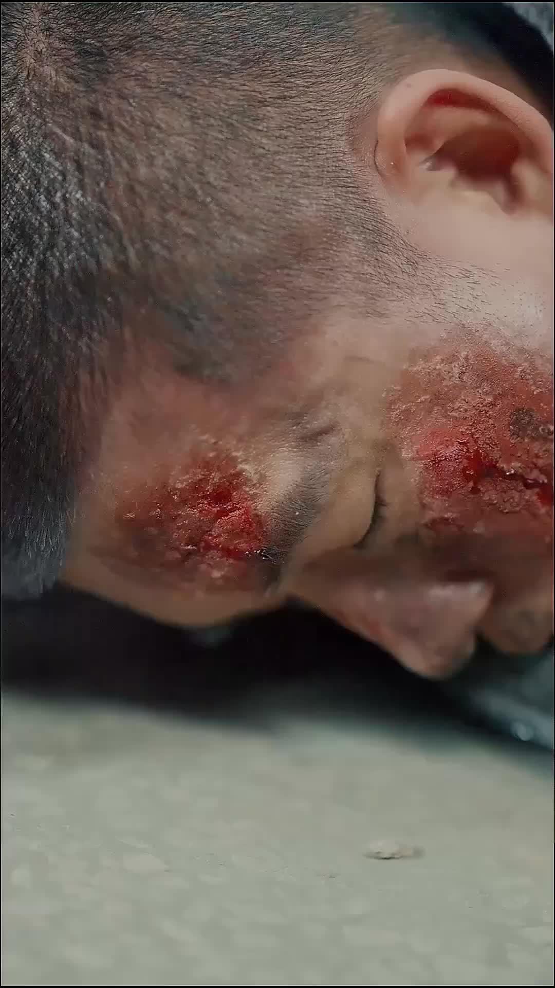 Ep 2
