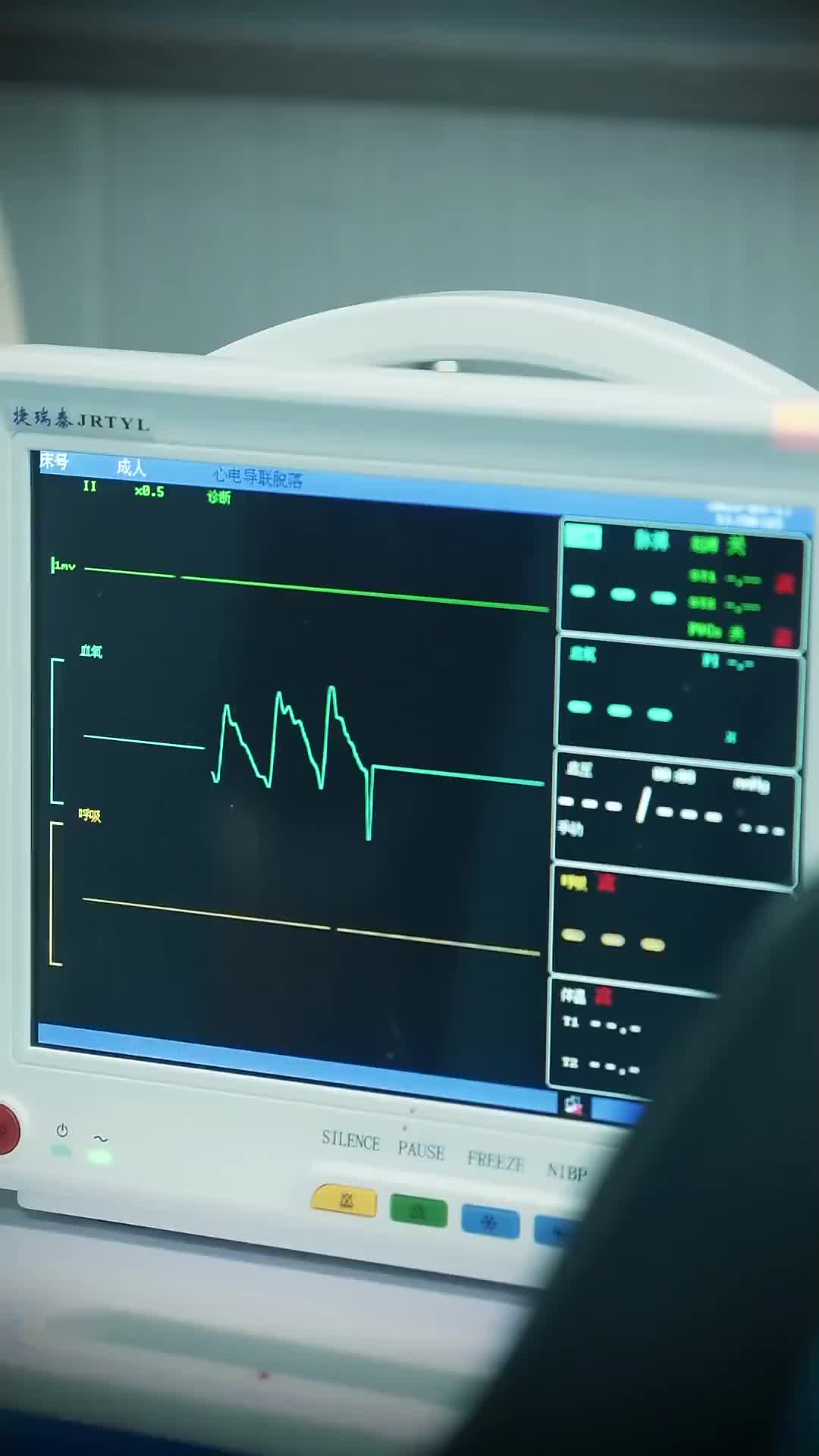 Ep 12